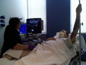 kidney transplant ultrasound